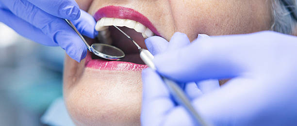 Best Chipped Tooth Repair Near Me  in Avon, OH
